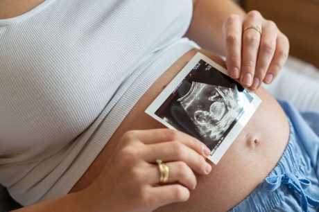 O que os americanos realmente pensam sobre o aborto